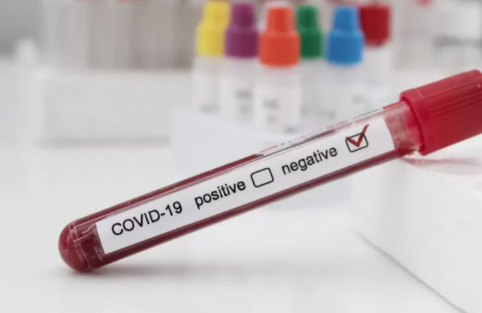 Lee más sobre el artículo Querétaro cumple una semana sin nuevos casos de Covid 19