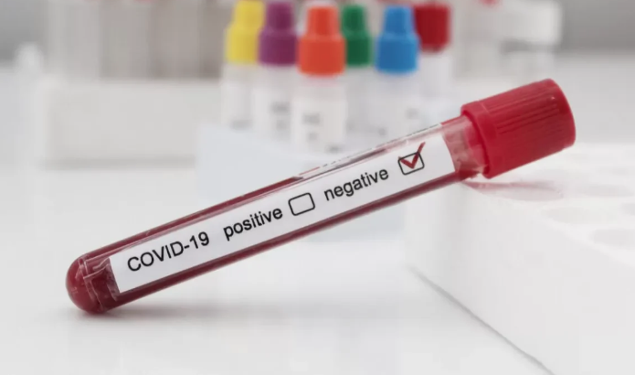 Lee más sobre el artículo Sin casos activos de Covid 19 en Querétaro